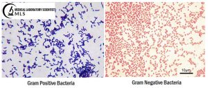 Gram Staining : Preparation Of Reagents, Procedure, Results ...