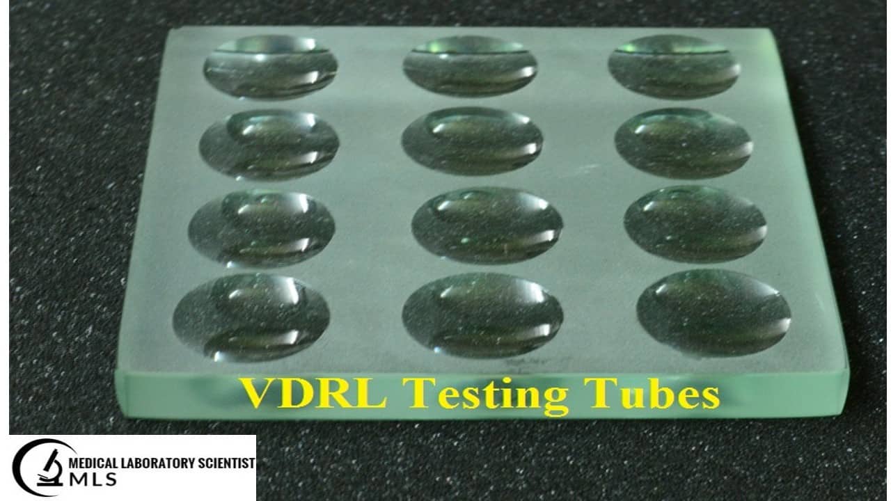 VDRL Testing tube