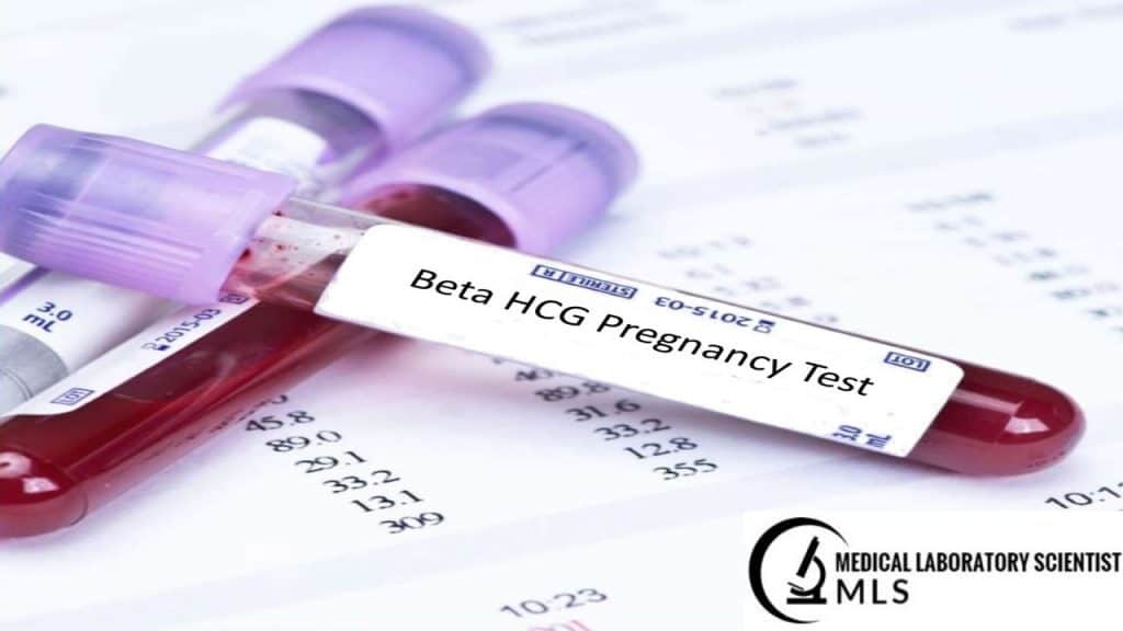 Pregnancy Test Principle Procedure Requirements And Interpretation