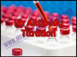 Rh Antibody Titration