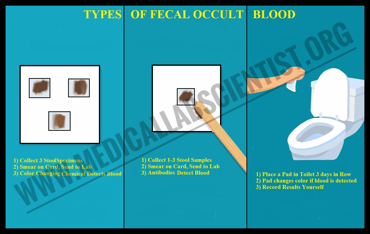 Types Of Faecal Occult Blood