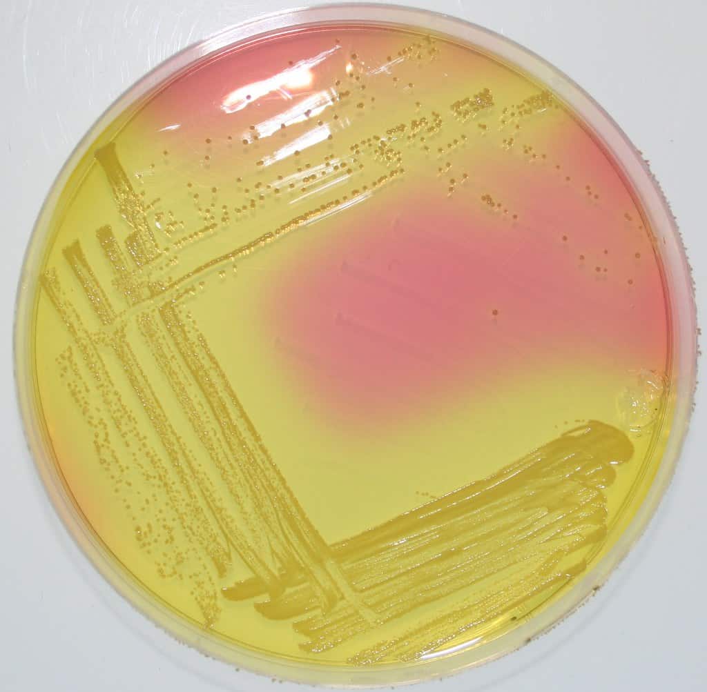 Staphylococcus Aureus on Mannitol Salt Agar