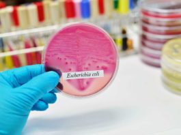 Laboratory Features of Escherichia coli