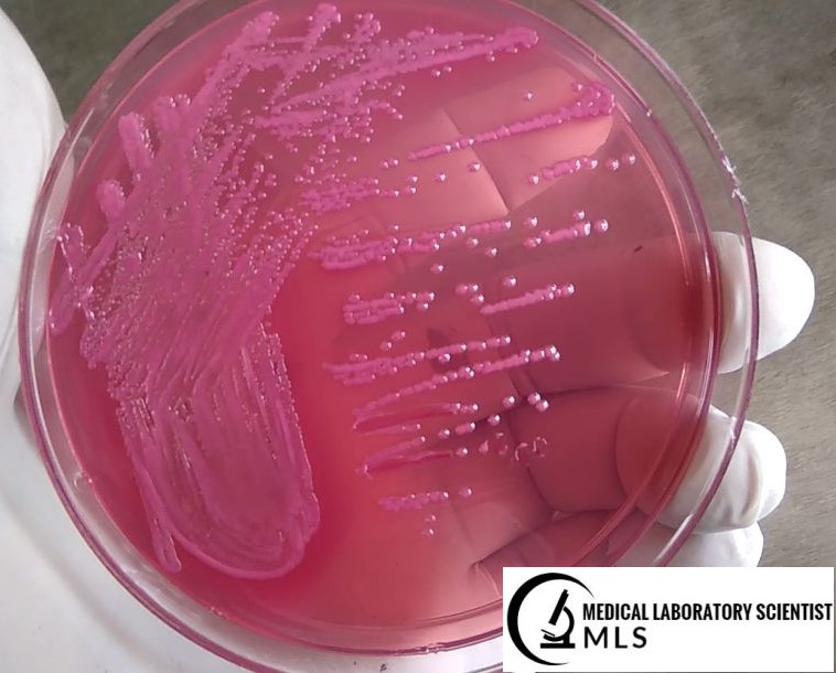 E.coli Growth on MacConkey Agar