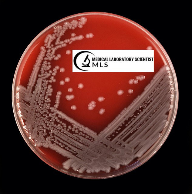 E.coli Growth on Blood Agar