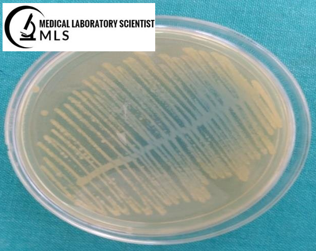 E.coli Growth on CLED Agar
