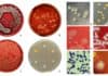 Staphylococcus Aureus – Cultural Characteristics