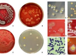 Staphylococcus Aureus – Cultural Characteristics