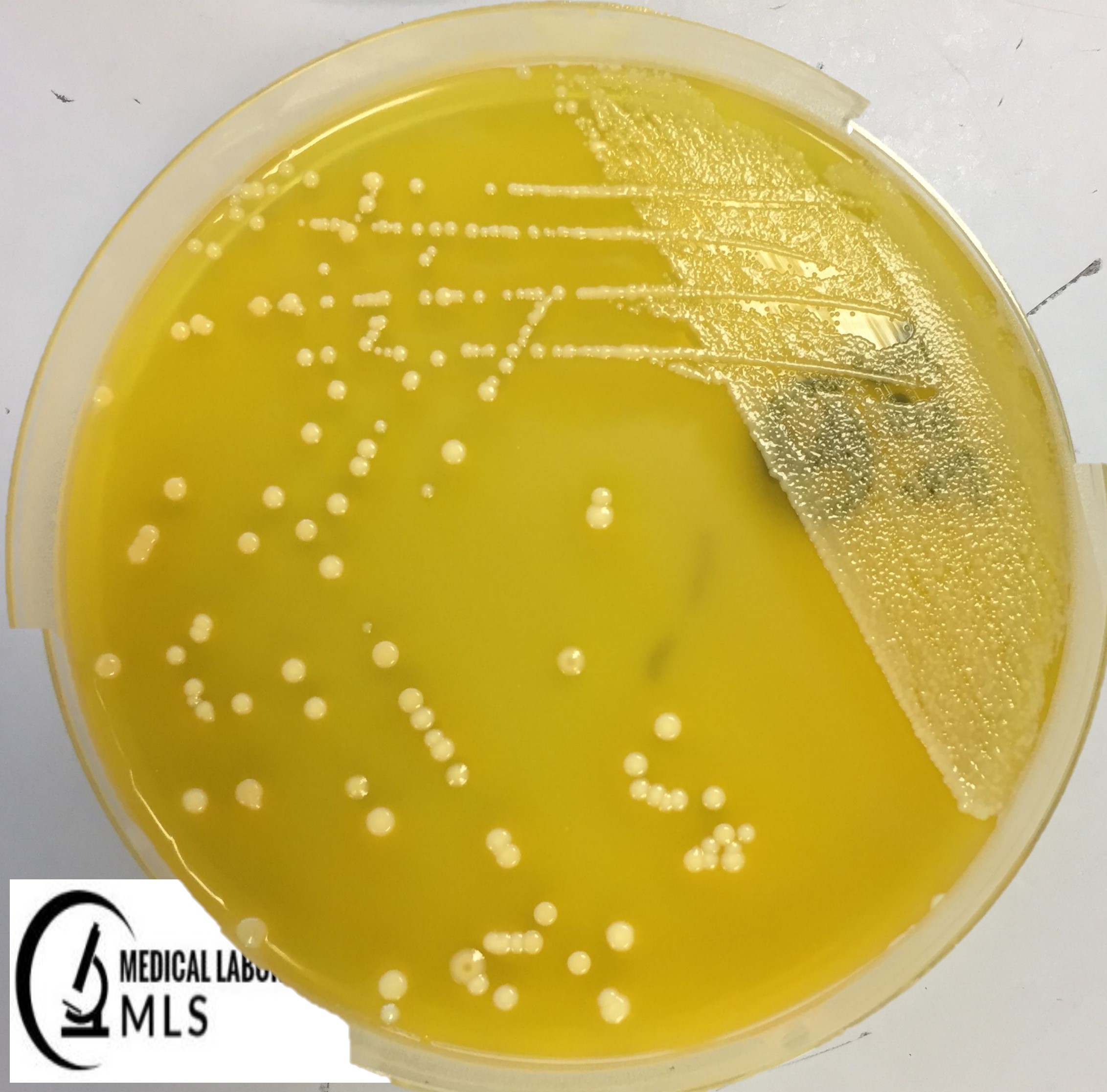 E.coli Growth on XLD Agar