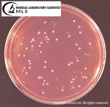 E.coli Growth on Sorbitol MacConkey Agar