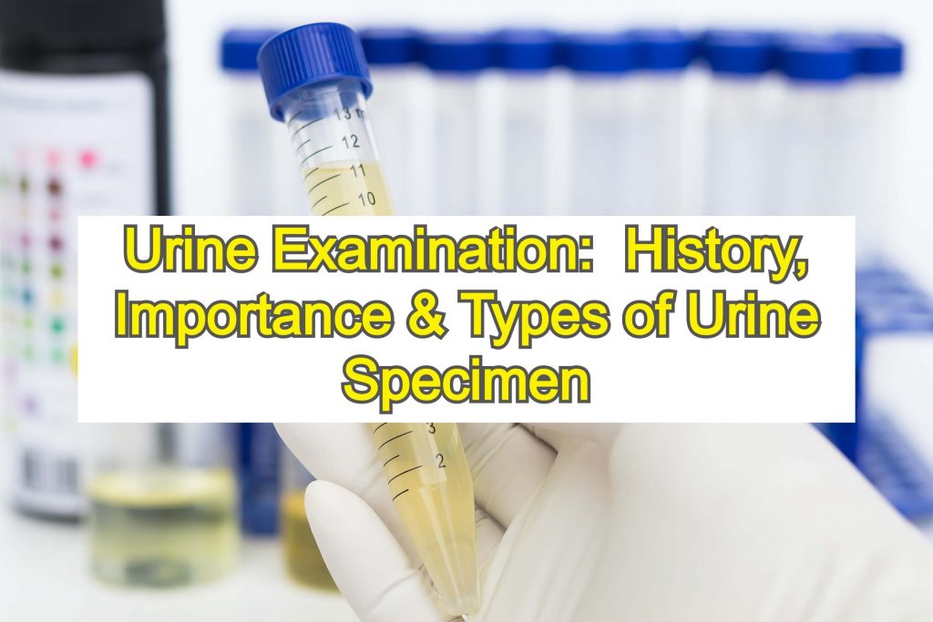 Urine Examination History, Importance & Types of Urine Specimen