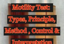 Motility Test: Types, Principle, Method, Control & Interpretation