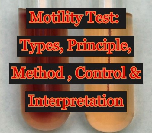 Motility Test: Types, Principle, Method, Control & Interpretation