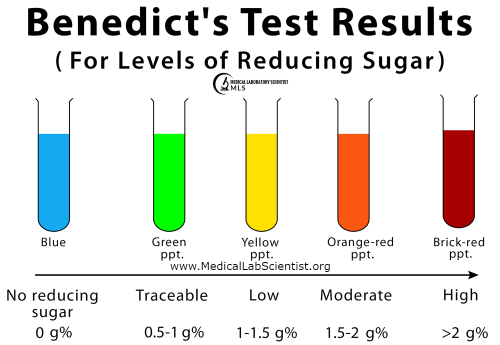 Benedicts-Test Results