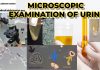 MICROSCOPIC URINALYSIS