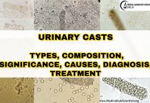 URINARY CASTS: Types, Composition, Significance, Causes, Diagnosis, Treatment