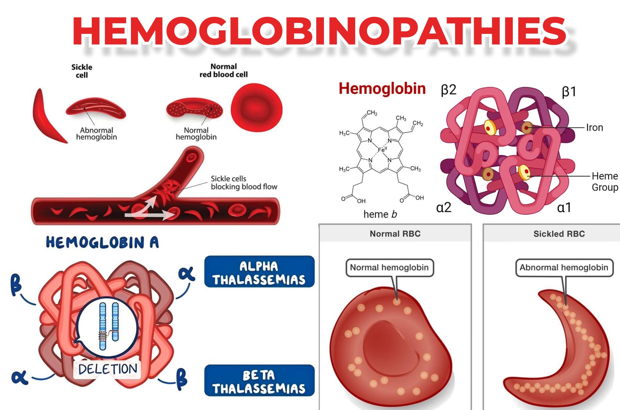 HEMOGLOBINOPATHIES Types And Clinical Insights Medical Laboratory   HEMOGLOBINOPATHIES 2048x1356 