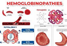 HEMOGLOBINOPATHIES