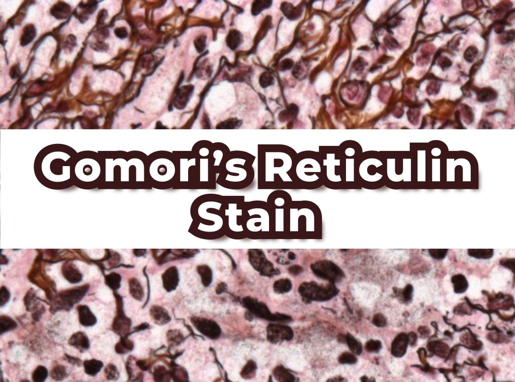 Gomori's Reticulin Stain