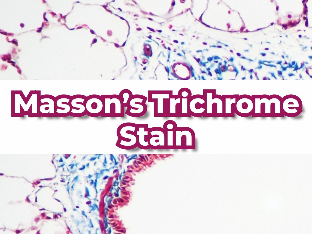 Massons Trichrome Stain
