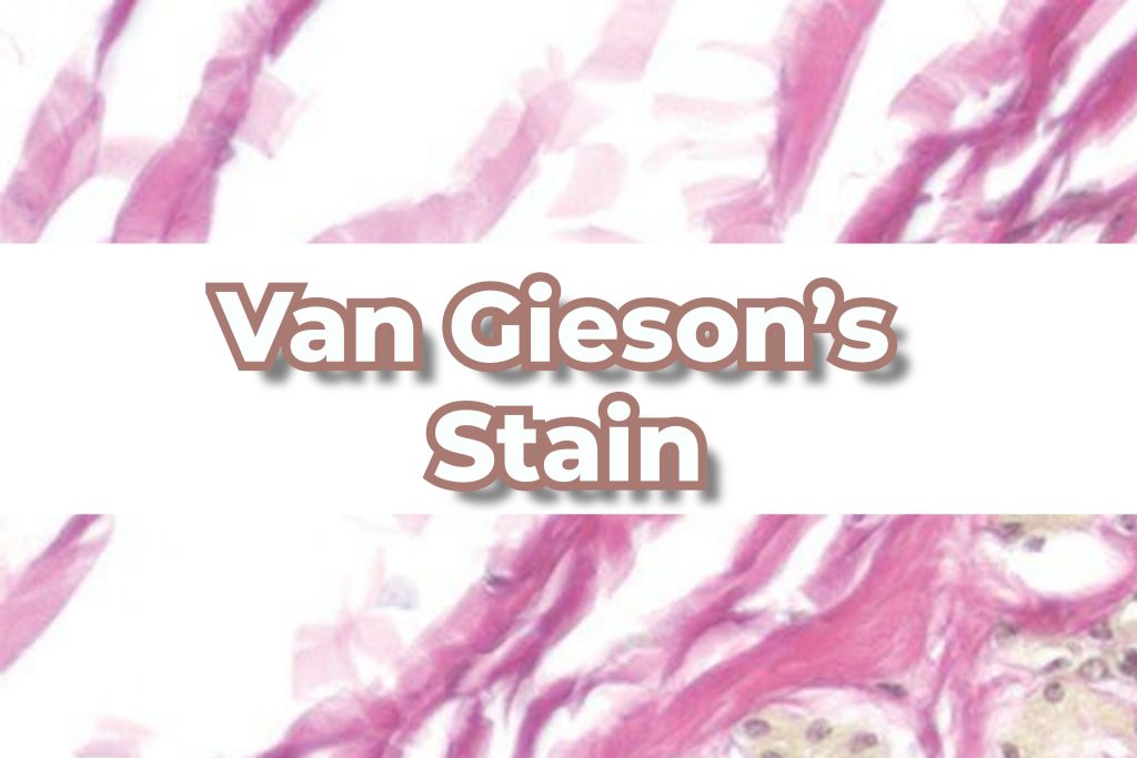 Van Gieson's Stain