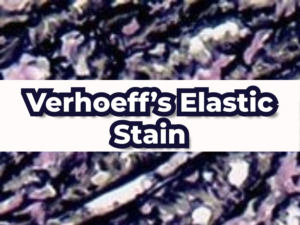Verhoeff's Elastic Stain