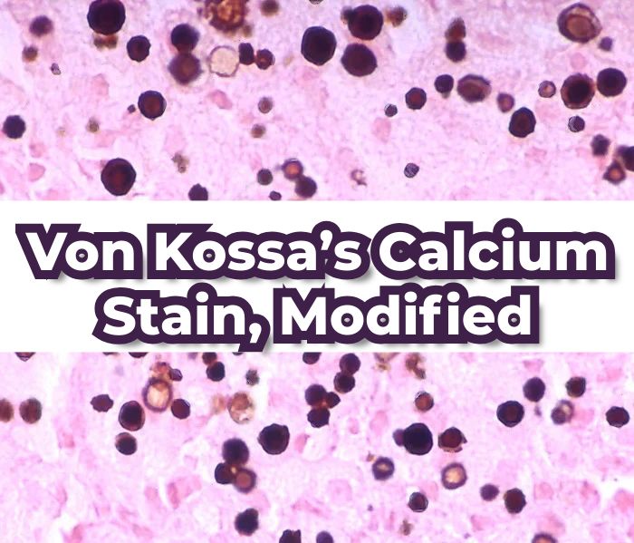 Von Kossa’s Calcium Stain, Modified