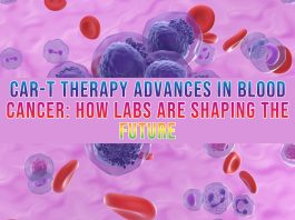CAR-T Therapy Advances in Blood Cancer How Labs Are Shaping the Future