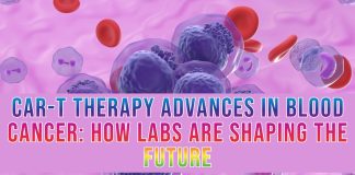 CAR-T Therapy Advances in Blood Cancer How Labs Are Shaping the Future